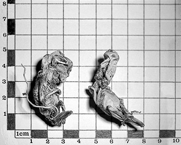 PICTURE: black and white photograph of two dehydrated human foetuse lying on top of a centimeter grid before they were rehydrated