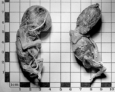 Black and white photograph of two rehydrated and freeze-dried human foetuses lying on top of a centimetre grid