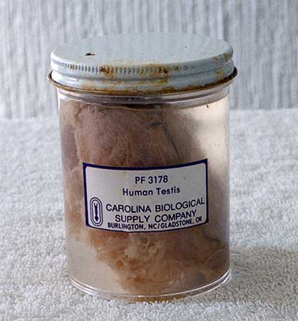 Color photo of glass jar containing the embalmed human testicle